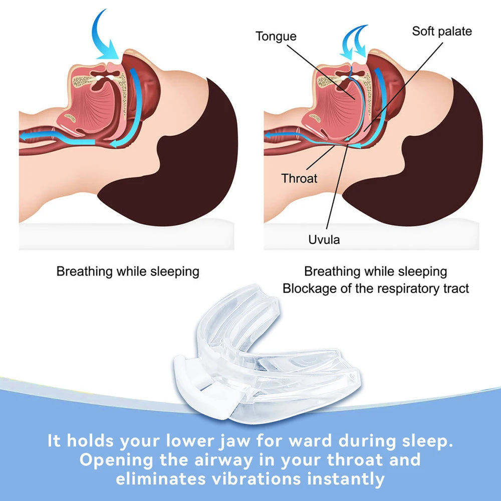 Anti Snoring Tooth Brace Adjustable anti Snoring Mouth Guard Easy Breathe Improve Sleeping Aid Apnea Mouthpiece to Stop Snoring